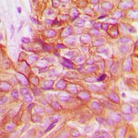 ADD1 / Adducin Alpha Antibody (C-Terminus)