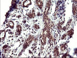 Monoclonal Mouse anti-Human UPRT Antibody (clone OTI1C9, IHC, WB)