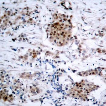 Polyclonal Rabbit anti-Human ER Alpha / Estrogen Receptor Antibody (phospho-Ser167, IHC, IF, WB)