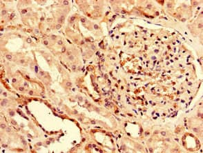 Polyclonal Rabbit anti-Human PUF60 Antibody (WB)