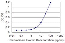 UBE2N / UBC13 Antibody (clone 4C11-G11)