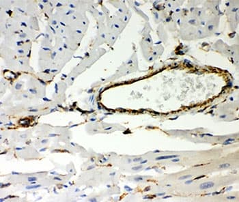Vimentin Antibody (aa435-465)