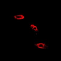 Polyclonal Rabbit anti-Human SHMT / SHMT2 Antibody (IHC, IF, WB)