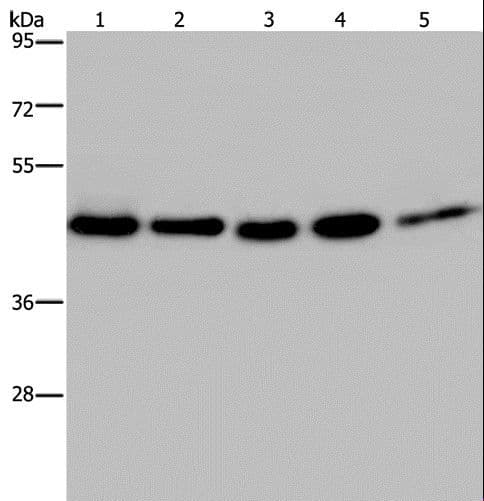 Polyclonal Rabbit anti-Human DNAJA1 / HDJ2 Antibody (IHC, WB)
