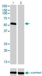 PathPlus™ FOXA1 Antibody (clone 2D7)