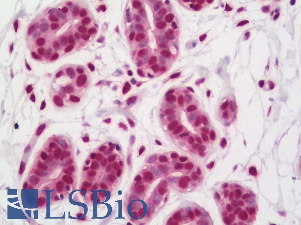 IHC-plus™ FUS / TLS Antibody