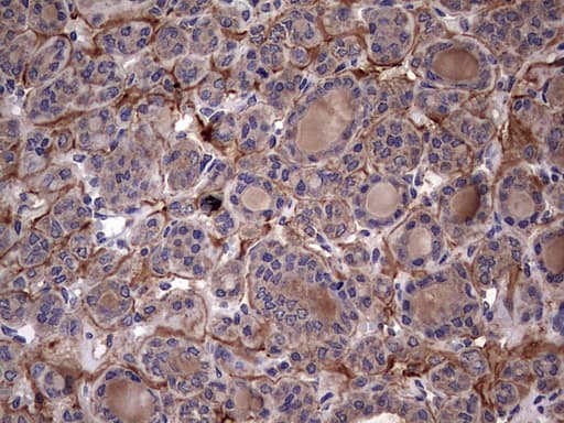 IL1RN Antibody (clone OTI2B1)