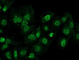 IHC-plus™ Monoclonal Mouse anti-Human DDX39B / UAP56 Antibody (clone 2E4, IHC, IF, WB)