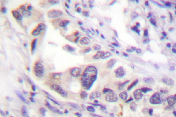 SMAD2 Antibody (Pro459)