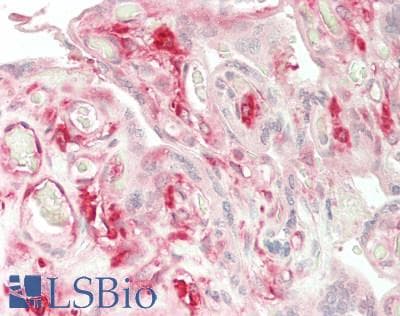 IHC-plus™ B2M / Beta 2 Microglobulin Antibody (aa 22-119)