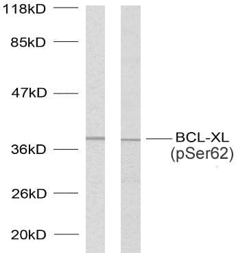 Polyclonal Rabbit anti-Human BCL2L1 / BCL-XL Antibody (phospho-Ser62, IHC, WB)