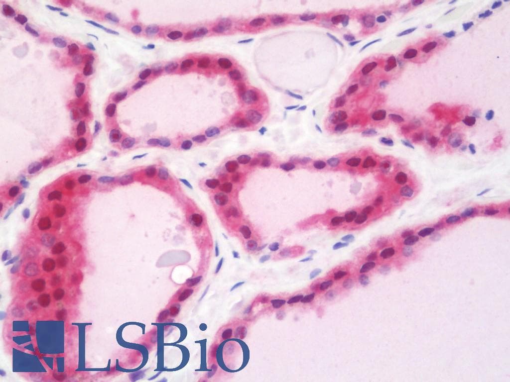 TPMT Antibody (HRP)