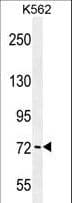 IHC-plus™ PAK6 Antibody (aa268-297)