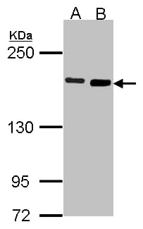 DIAPH1 Antibody (aa1-237)
