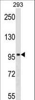 SPIRE1 Antibody (aa665-691)