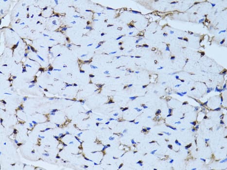 Polyclonal Rabbit anti-Human FABP4 / AP2 Antibody (IHC, IF, WB)