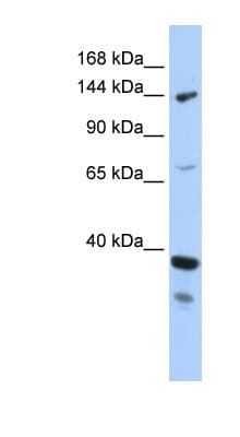 DHX37 Antibody (aa71-120)
