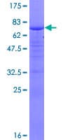 Human KIAA0191 / ZCCHC11 Protein (Recombinant GST)