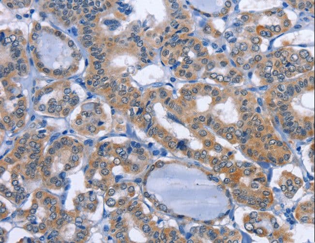 UCK1 Antibody