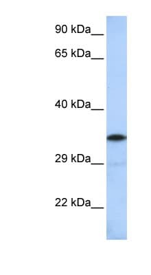Polyclonal Rabbit anti-Human KCTD4 Antibody (aa144-193, WB)