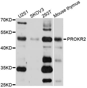 PROKR2/Prokineticin Receptor 2 Antibody
