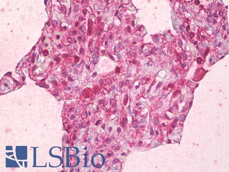 IHC-plus™ ABCB7 Antibody (aa691-740)