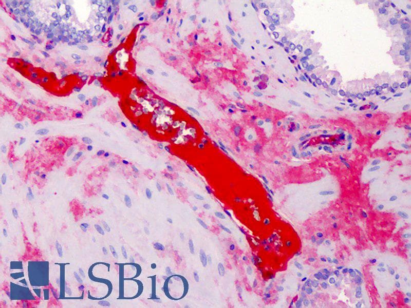 IHC-plus™ A2M / Alpha-2-Macroglobulin Antibody