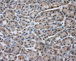 NPR3 Antibody (clone OTI11A6)