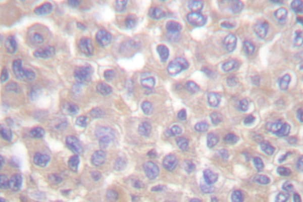 Polyclonal Rabbit anti-Human TRADD Antibody (Leu282, IHC, WB)