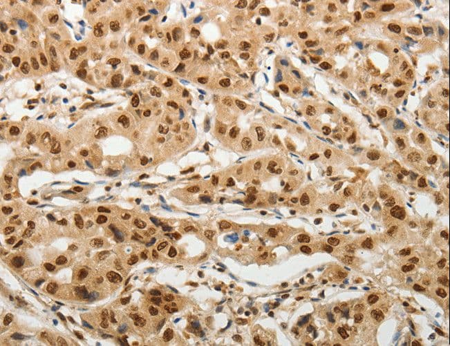 SOCS7 / SOCS-7 Antibody