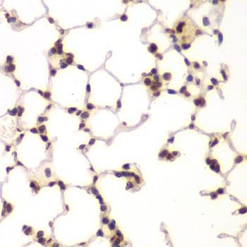 NIRF / UHRF2 Antibody