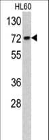 TOMM70A Antibody (aa579-608)