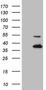 NAPSA / NAPA / Napsin A Antibody (aa64-244, clone OTI1B5)