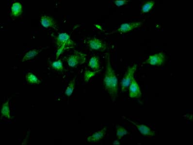 Polyclonal Rabbit anti-Human USP4 Antibody (IHC, IF, WB)