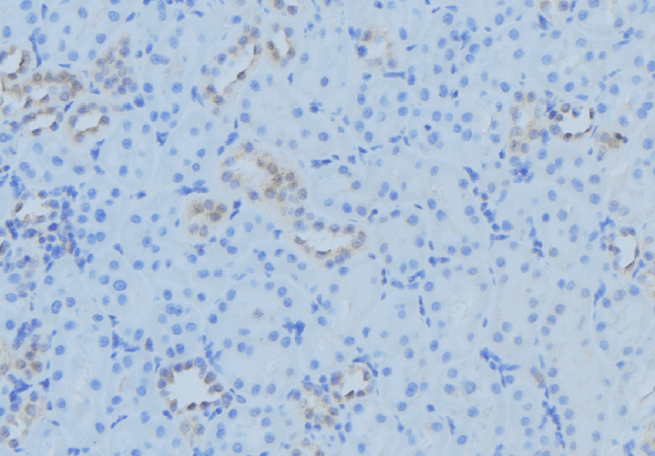 TAMM41 / C3orf31 Antibody