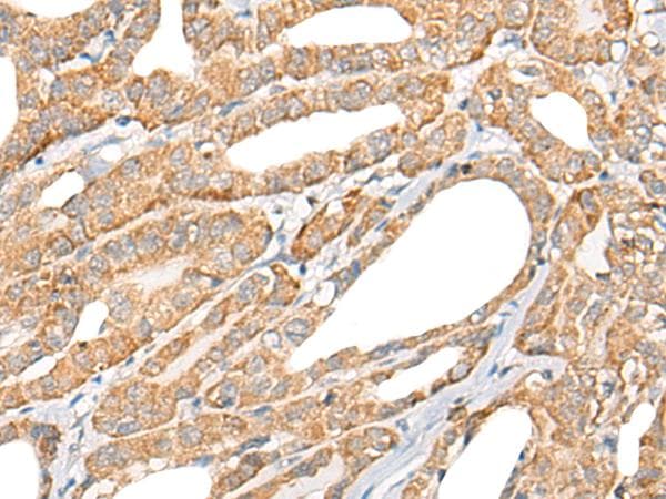 CCL5 / RANTES Antibody