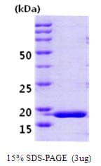 Human PPIH / Cyclophilin H Protein (Recombinant)
