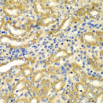 Polyclonal Rabbit anti-Human GOPC / PIST Antibody (IHC, IF, WB)