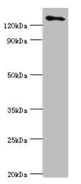 USP8 / UBPY Antibody (aa1-270)
