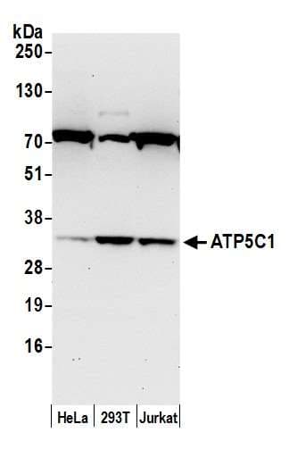 Polyclonal Rabbit anti-Human ATP5C1 Antibody (aa248-298, WB)