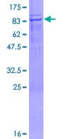 Human UBOX5 Protein (Recombinant GST)