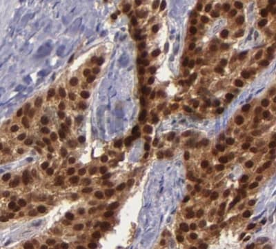 BAG1 / BAG-1 Antibody