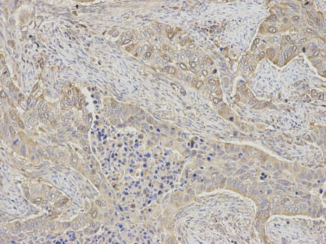 Polyclonal Rabbit anti-Human RRM2 Antibody (IHC, IF, WB)