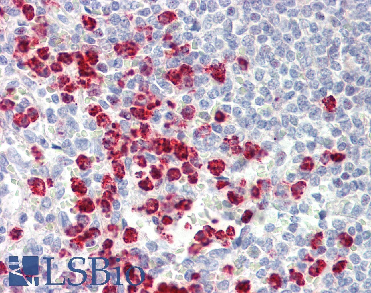 IHC-plus™ ORMDL3 Antibody (aa53-81)
