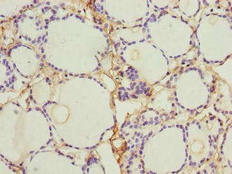 NINJ2 / Ninjurin 2 Antibody