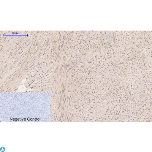 CASP1 / Caspase 1 Antibody