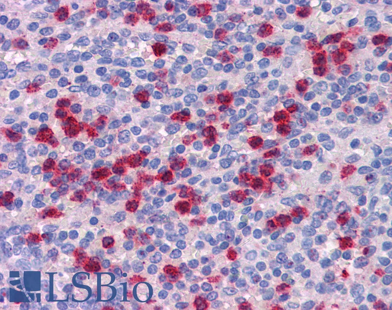 IHC-plus™ Polyclonal Rabbit anti-Human CRACR2B / EFCAB4A Antibody (IHC, WB)