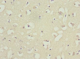 Polyclonal Rabbit anti-Human BAR / BFAR Antibody (IHC)