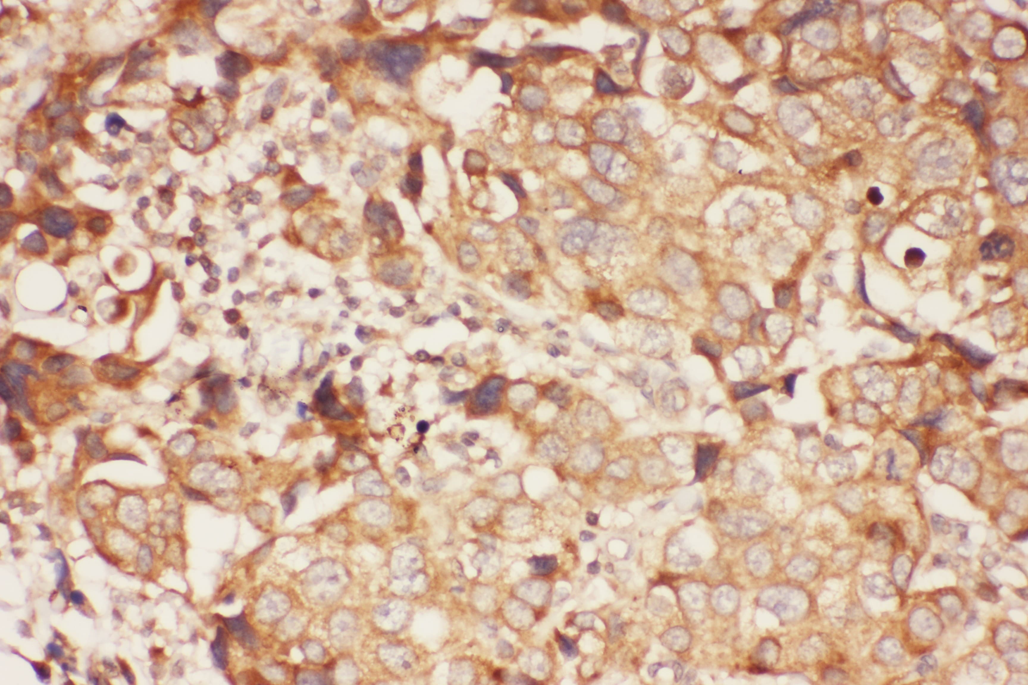 Polyclonal Rabbit anti-Human ALOX15 / 15-Lipoxygenase Antibody (aa2-337, IHC, WB)