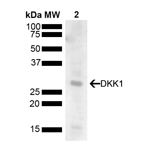 DKK1 Antibody